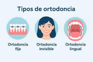 Comparativa entre ortodoncia fija con brackets y ortodoncia invisible con alineadores transparentes